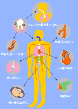 悪玉菌による全身疾患