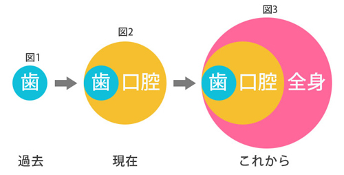 新しい予防歯科へ