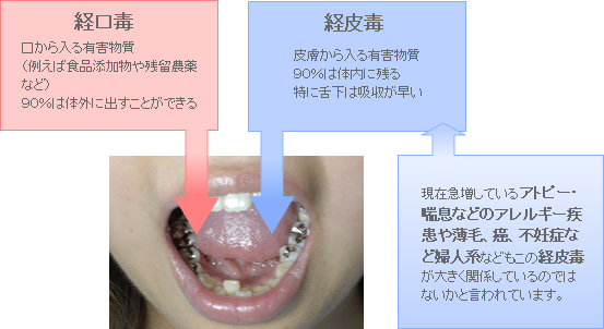 経口毒、経皮毒について