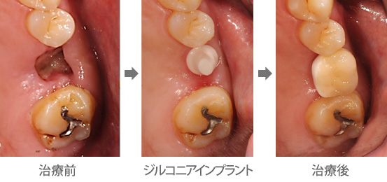 症例